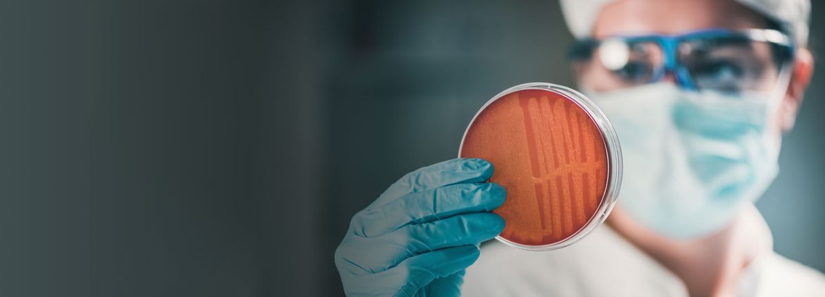 Scientist inspecting a culture plate
